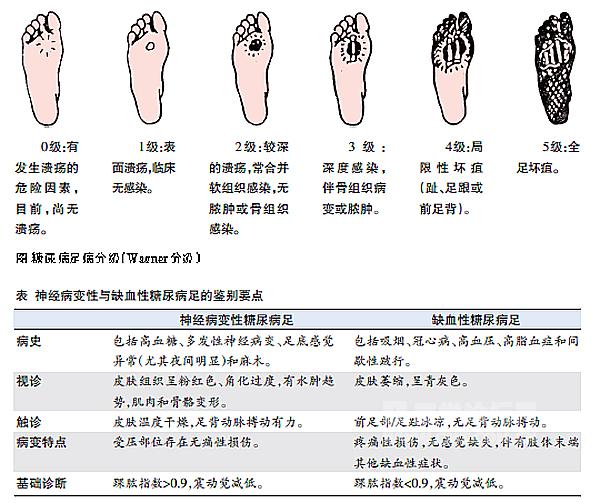 糖尿病足分级及图片